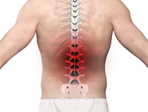 How to Treat a Pulled Back Muscle in 8 Steps - NJ's Top Orthopedic Spine &  Pain Management Center